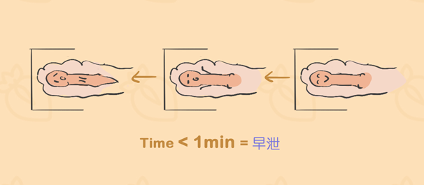 中山治早泄,中山治早泄医院,中山哪家医院治早泄好